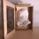 Impresión de Ecografía en 3D